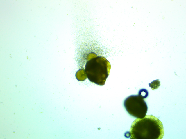 Actual hydrodynamic cavitation and cell lysis from using a Infinity Supercritical SDR system using hops mixed with waterActual hydrodynamic cavitation and cell lysis from using a Infinity Supercritical SDR system using hops mixed with water 100x microscope magnification