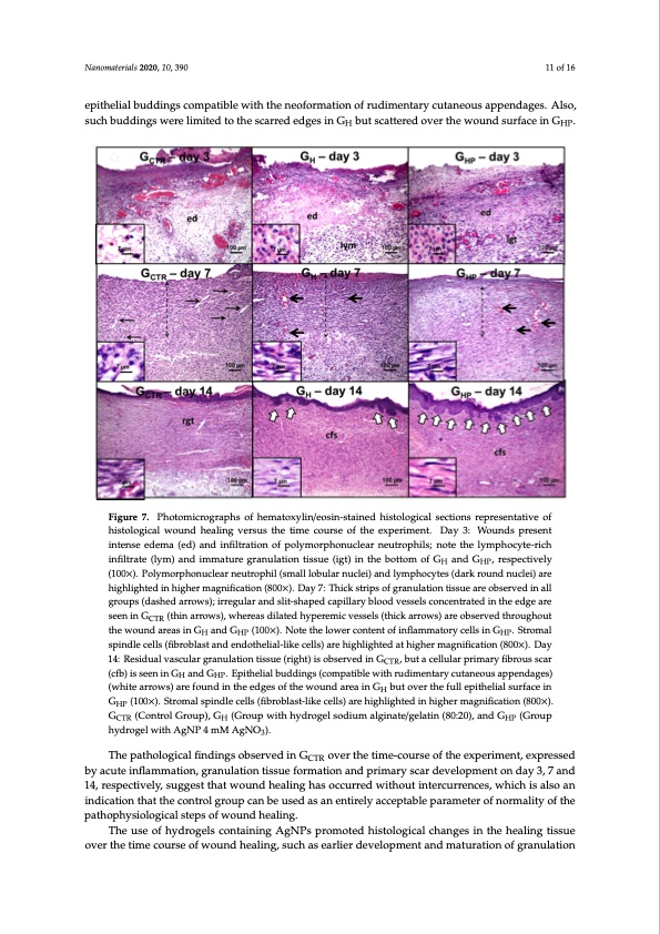 wound-healing-silver-nanoparticles-composing-hydrogel-011
